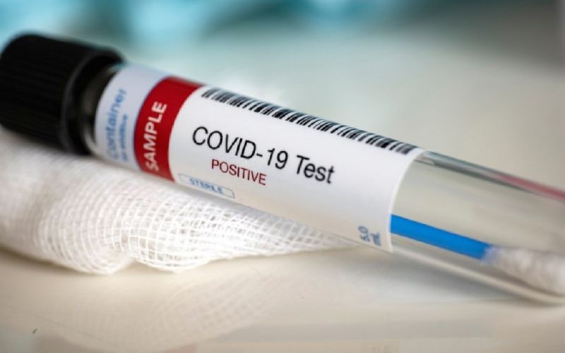 Las pruebas positivas en pacientes recuperados de COVID-19 no son reinfecciones: OMS