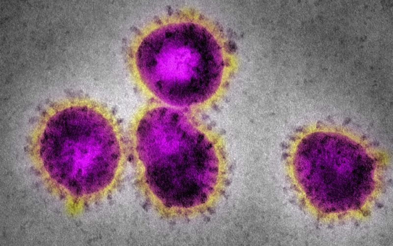 Panel científico envía carta a la Casa Blanca, el coronavirus no desaparece con un clima más cálido