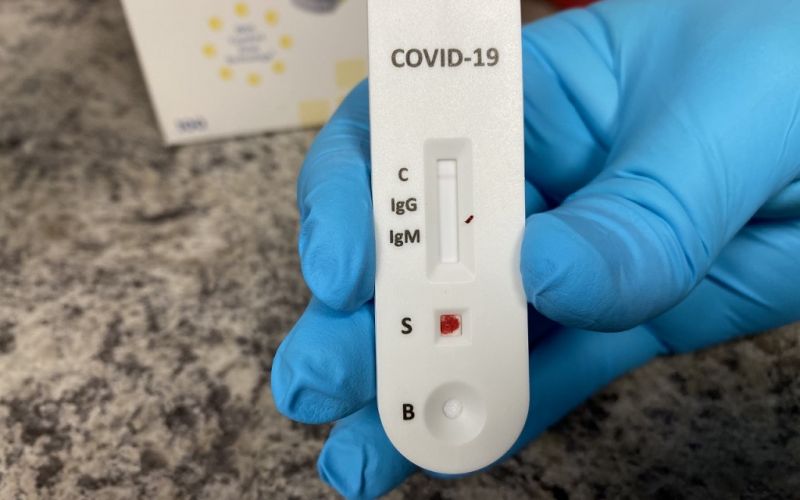 Pruebas de anticuerpos contra el coronavirus ¿son efectivas?