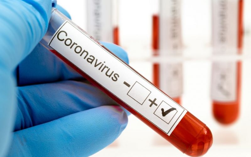 20 laboratorios recibirán apoyo de Conacyt para realizar pruebas de coronavirus (Comunicado)