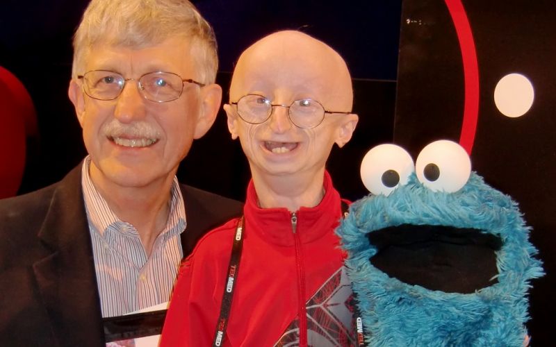 FDA aprueba el primer fármaco para la progeria, una enfermedad de rápido envejecimiento