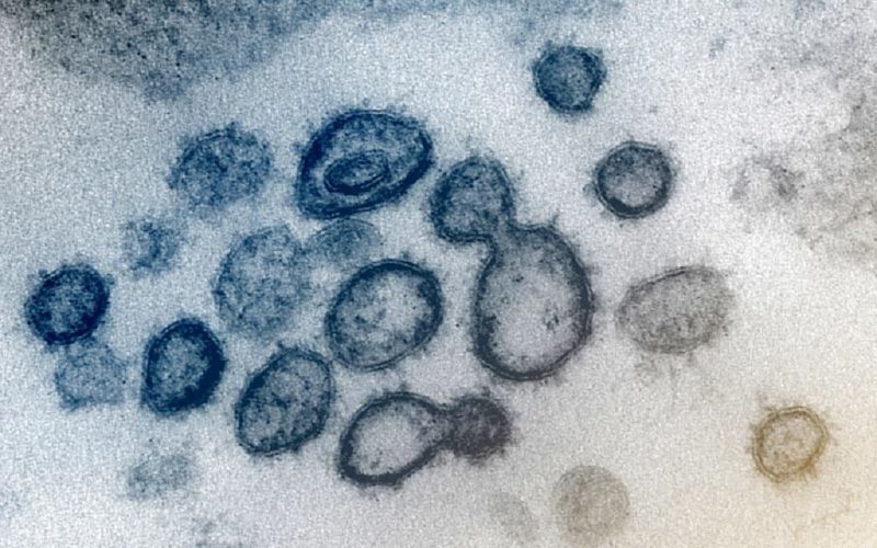Equipo científico investigará los orígenes de la pandemia de COVID-19