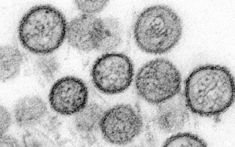 Identifican primer caso de hantavirus en Michigan, Estados Unidos