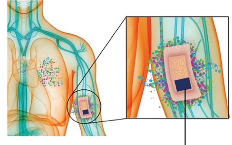 Científicos desarrollan parche adhesivo para el diagnóstico de tuberculosis